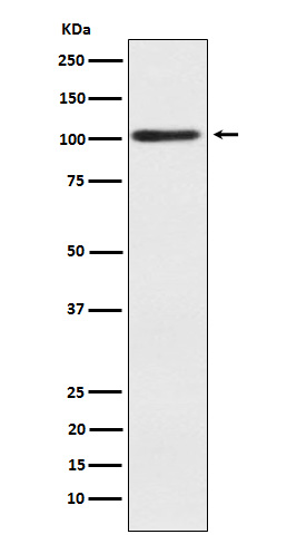 Western blot analysis of Alpha actinin 2 expression in human skeletal muscle lysate