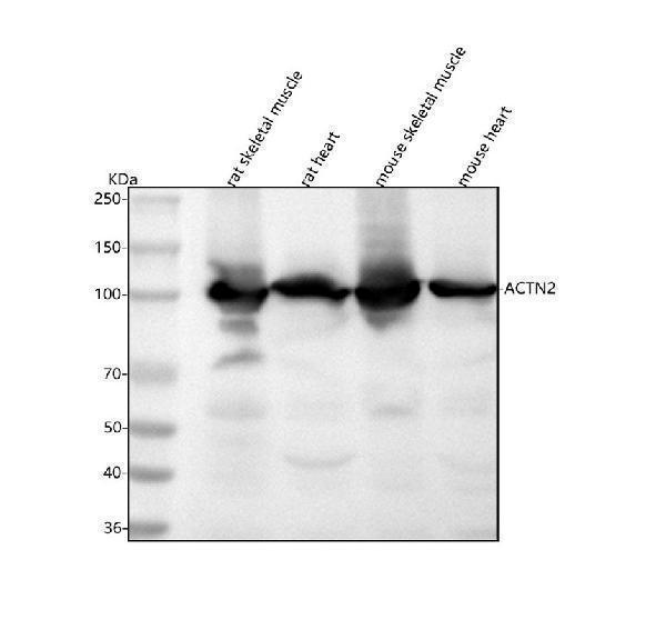  Western blot analysis of ACTN2 using anti-ACTN2 antibody (M03673)
