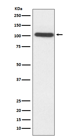 Western blot analysis of ACTN2 expression in HepG2 cell lysate