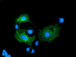 m03682 2 lman1 primary antibodies if testing 11
