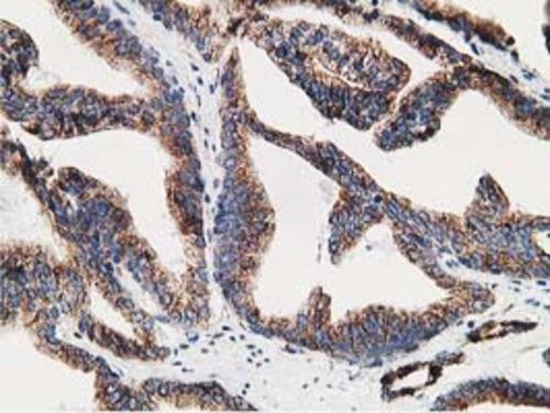 m03682 2 lman1 primary antibodies ihc testing 10