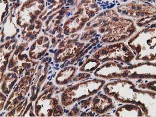 m03682 2 lman1 primary antibodies ihc testing 5