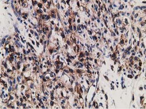m03682 2 lman1 primary antibodies ihc testing 6