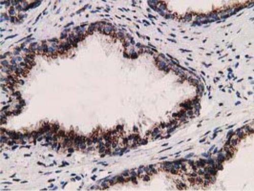 m03682 2 lman1 primary antibodies ihc testing 9