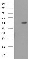 HEK293T cells were transfected with the pCMV6-ENTRY control (Left lane) or pCMV6-ENTRY LMAN1 (Right lane) cDNA for 48 hrs and lysed