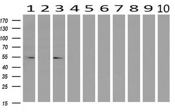 Western blot analysis of extracts (10ug) from 10 Human tissue by using anti-LMAN1 monoclonal antibody at 1:200 (1: Testis; 2: Omentum; 3: Uterus; 4: Breast; 5: Brain; 6: Liver; 7: Ovary; 8: Thyroid gland; 9: colon;10: spleen)