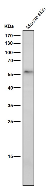 All lanes use the Antibody at 1:1K dilution for 1 hour at room temperature