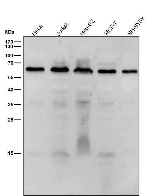 All lanes use the Antibody at 1:1K dilution for 1 hour at room temperature