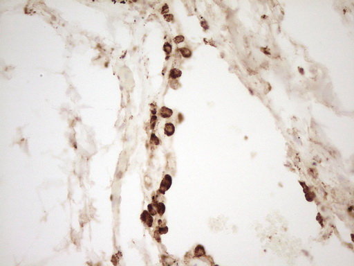 m03689 anti renin ren mouse monoclonal antibody clone id oti2f10 ihc testing 10