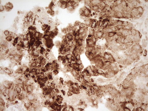 m03689 anti renin ren mouse monoclonal antibody clone id oti2f10 ihc testing 2