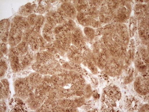 m03689 anti renin ren mouse monoclonal antibody clone id oti2f10 ihc testing 3
