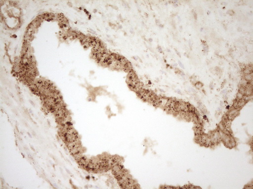 m03689 anti renin ren mouse monoclonal antibody clone id oti2f10 ihc testing 4