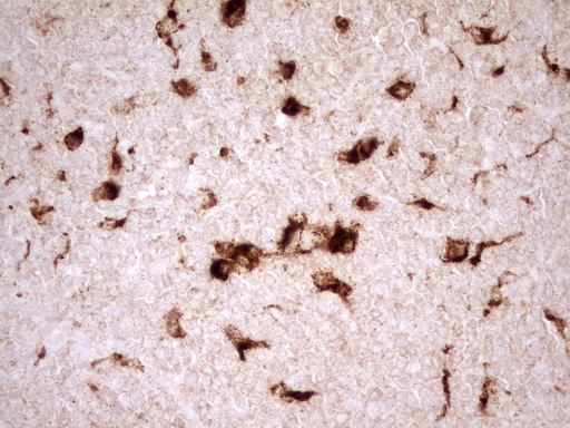 m03689 anti renin ren mouse monoclonal antibody clone id oti2f10 ihc testing 5