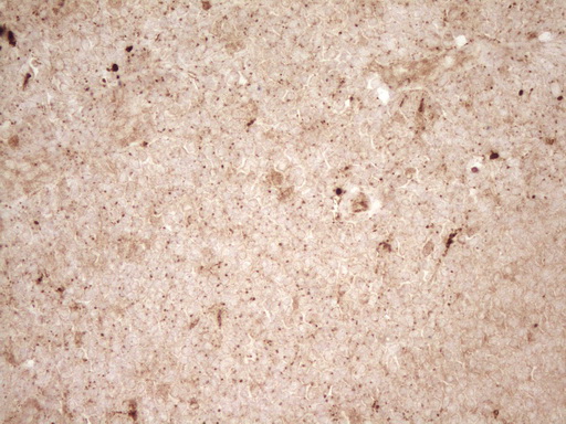 m03689 anti renin ren mouse monoclonal antibody clone id oti2f10 ihc testing 6