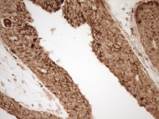 m03689 anti renin ren mouse monoclonal antibody clone id oti2f10 ihc testing 7