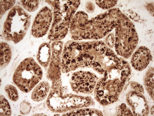 m03689 anti renin ren mouse monoclonal antibody clone id oti2f10 ihc testing 8