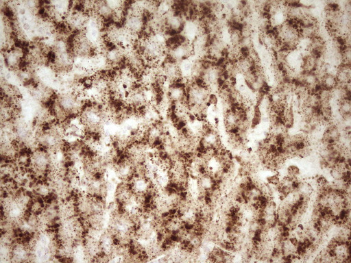 m03689 anti renin ren mouse monoclonal antibody clone id oti2f10 ihc testing 9