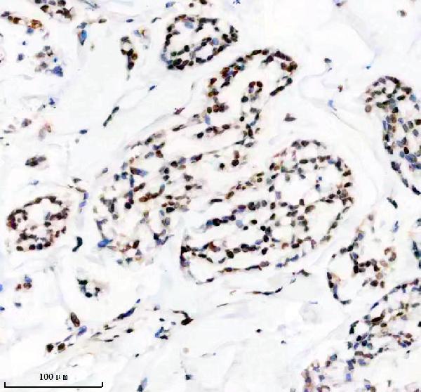 IHC analysis of hnRNPU using anti-hnRNPU antibody (M03691)