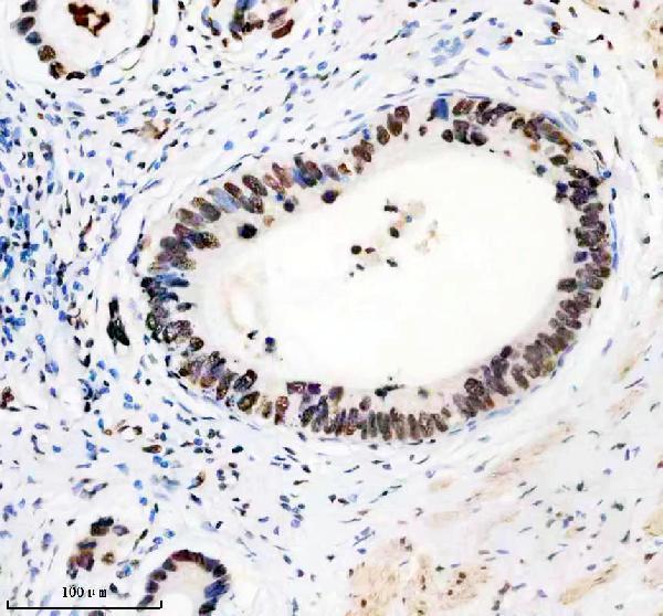 m03691 hnrnpu primary antibodies ihc testing 10