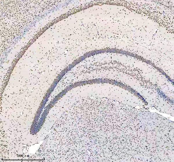 m03691 hnrnpu primary antibodies ihc testing 11