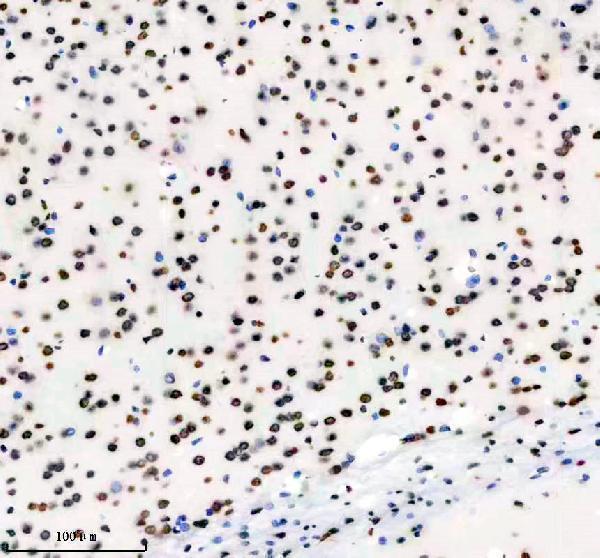 m03691 hnrnpu primary antibodies ihc testing 12
