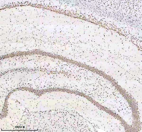 m03691 hnrnpu primary antibodies ihc testing 13