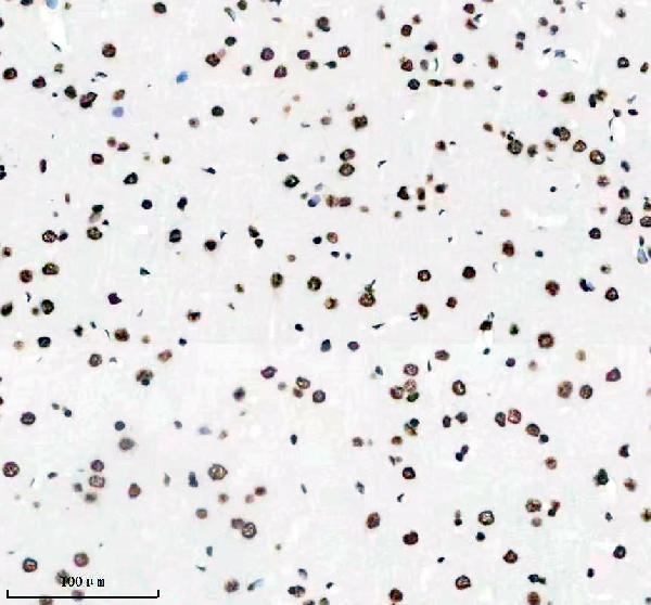 m03691 hnrnpu primary antibodies ihc testing 14