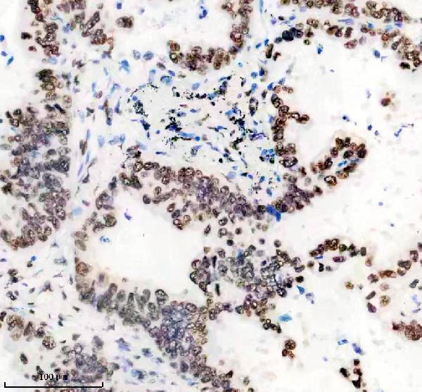 IHC analysis of hnRNPU using anti-hnRNPU antibody (M03691)