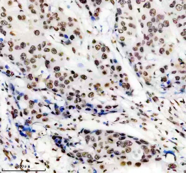 m03691 hnrnpu primary antibodies ihc testing 3