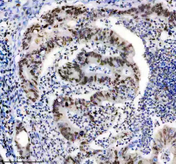 m03691 hnrnpu primary antibodies ihc testing 4
