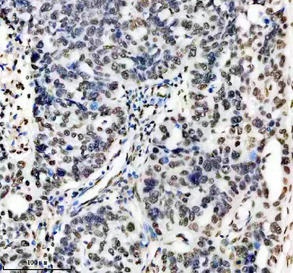 m03691 hnrnpu primary antibodies ihc testing 5
