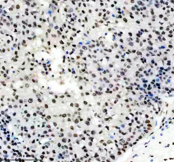 m03691 hnrnpu primary antibodies ihc testing 7