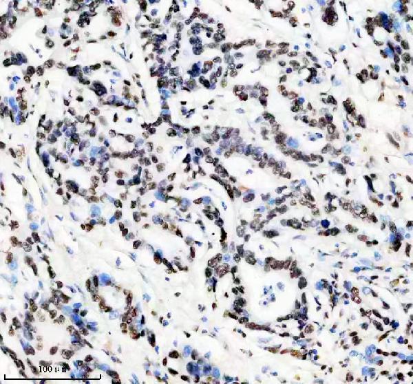 m03691 hnrnpu primary antibodies ihc testing 8