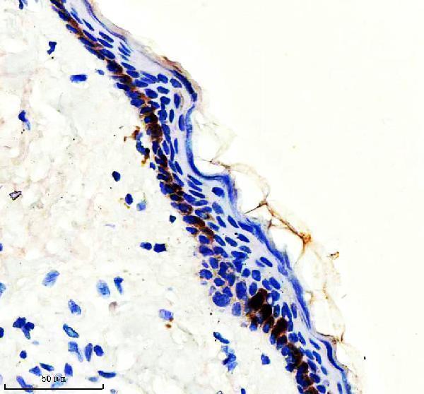 IHC analysis of KRT9 using anti-KRT9 antibody (M03692)