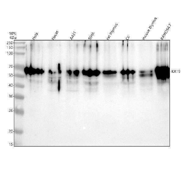 Western blot analysis of KRT9 using anti-KRT9 antibody (M03692)