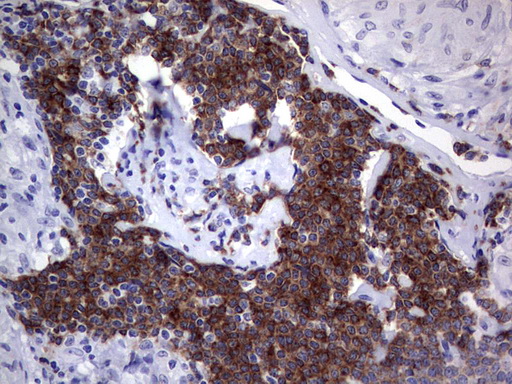 Immunohistochemical staining of paraffin-embedded Human lymph node tissue within the normal limits using anti-TFPI2 mouse monoclonal antibody