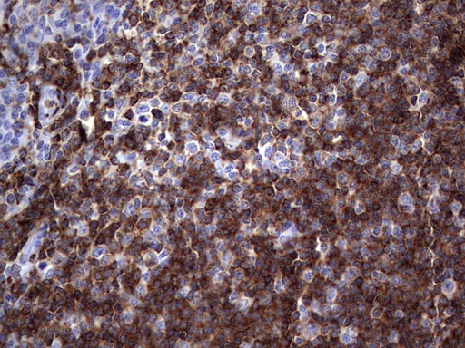 m03697 anti tfpi2 mouse monoclonal antibody clone id oti1d4 ihc testing 4