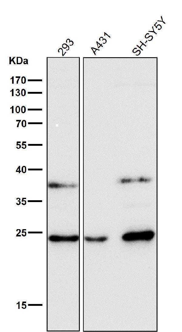 All lanes use the Antibody at 1:1K dilution for 1 hour at room temperature