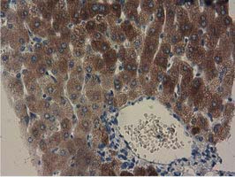 Immunohistochemical staining of paraffin-embedded Human liver tissue within the normal limits using anti-GSTA4 mouse monoclonal antibody at 1:150 (M03699)