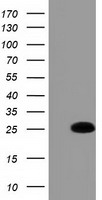 HEK293T cells were transfected with the pCMV6-ENTRY control (Left lane) or pCMV6-ENTRY GSTA4 (Right lane) cDNA for 48 hrs and lysed