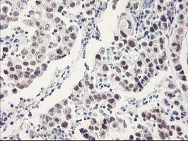 m03708 1 anti rbap46 rbbp7 mouse monoclonal antibody clone id oti4c9 ihc testing 4