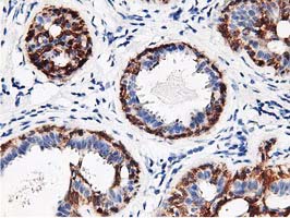 m03708 2 anti rbap46 rbbp7 mouse monoclonal antibody clone id oti2d8 ihc testing 4