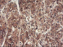 m03708 anti rbap46 rbbp7 mouse monoclonal antibody clone id oti5a4 ihc testing 11