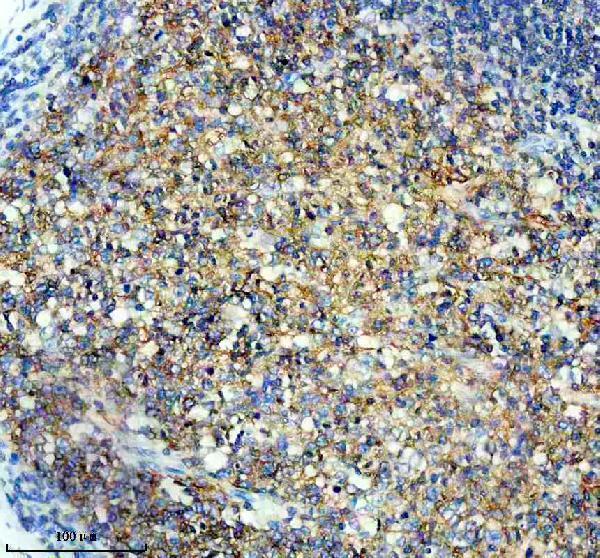 m03711 1 pag1 primary antibodies ihc testing 3