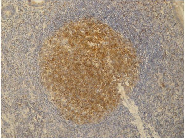 Immunohistochemistry staining (paraffin sections) of PAG/Cbp in germinal center of lymphatic follicle and in dispersed T cells in human appendix tissue by monoclonal antibody PAG-C1