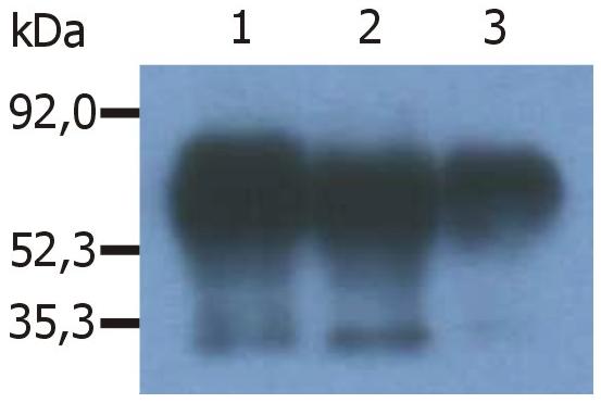 Immunoprecipitation of human PAG/Cbp from the lysate of RAJI human Burkitt lymphoma cell line