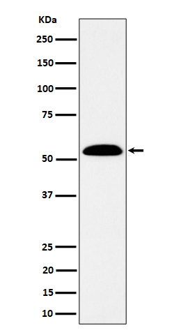 Western blot analysis of ALDH7A1 expression in SW480 cell lysate