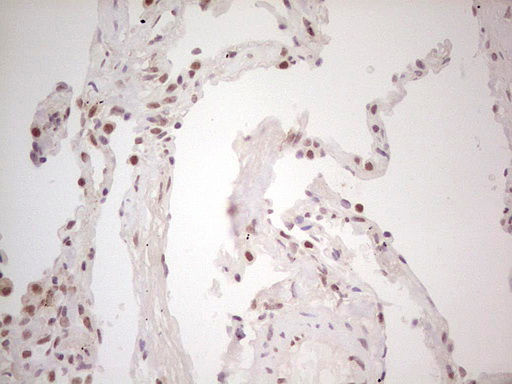 Immunohistochemical staining of paraffin-embedded Human lung tissue within the normal limits using anti-TRIB1 mouse monoclonal antibody