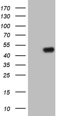 HEK293T cells were transfected with the pCMV6-ENTRY control (Left lane) or pCMV6-ENTRY TRIB1 (Right lane) cDNA for 48 hrs and lysed