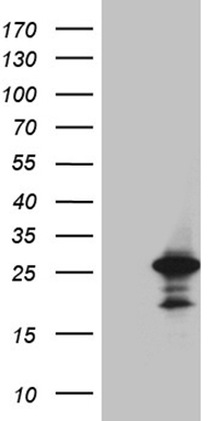 HEK293T cells were transfected with the pCMV6-ENTRY control (Left lane) or pCMV6-ENTRY RAB18 (Right lane) cDNA for 48 hrs and lysed